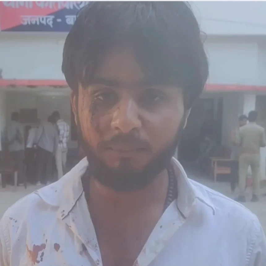 बहराइच कॉलेज में छात्र पर हमला — Degree लेने आया था, सिर फटा कर लौटा; पुलिस ने FIR से किया इनकार उत्तर प्रदेश के बहराइच जिले से एक बेहद चौंकाने वाली और दिल दहला देने वाली घटना सामने आई है। Kisan PG College, Bahraich में degree लेने आए एक छात्र पर अज्ञात लोगों ने sharp weapon से बर्बर हमला कर दिया। छात्र का सिर बुरी तरह फट गया और वह लहूलुहान हो गया। लेकिन इससे भी ज्यादा दर्दनाक वह बात है जो इसके बाद हुई — जब छात्र न्याय मांगने पुलिस के पास पहुंचा तो पुलिस ने FIR दर्ज करने से साफ इनकार कर दिया। क्या है पूरा मामला? बताया जा रहा है कि पीड़ित छात्र UGC यानी University Grants Commission की कुछ नीतियों का विरोध कर रहा था। वह अपनी degree लेने के लिए Kisan PG College गया था — एक साधारण काम, जो किसी के लिए भी रोज की बात होती है। लेकिन college campus के अंदर ही अज्ञात लोगों ने उस पर sharp weapon से हमला कर दिया। हमला इतना भीषण था कि छात्र का सिर फट गया और उसे तुरंत medical attention की जरूरत पड़ी। पुलिस का रवैया — न्याय की उम्मीद पर पानी हमले के बाद छात्र और उसके परिजन न्याय की उम्मीद लेकर पुलिस के पास पहुंचे। लेकिन जो हुआ वह किसी को भी अंदर से हिला देने वाला है। पुलिस ने FIR दर्ज करने से इनकार कर दिया। एक घायल छात्र जो college campus के अंदर हमले का शिकार हुआ, उसे पुलिस ने न्याय देने से मना कर दिया। यह घटना न सिर्फ एक छात्र के साथ हुए अन्याय की कहानी है बल्कि यह उस पूरे सिस्टम पर सवाल उठाती है जिसका काम आम लोगों को protect करना है। UGC का विरोध — क्या यही बनी वजह? सूत्रों के अनुसार पीड़ित छात्र UGC की कुछ policies के खिलाफ आवाज उठा रहा था। University Grants Commission की कुछ नीतियों को लेकर देशभर में students के बीच असंतोष रहा है। लेकिन किसी की बात से असहमति का जवाब sharp weapon से देना और फिर पुलिस का FIR दर्ज न करना — यह दोनों बातें मिलकर एक गंभीर सवाल खड़ा करती हैं कि क्या इस देश में आवाज उठाना अब खतरनाक हो गया है? Campus Security पर उठे सवाल यह घटना Kisan PG College के campus के अंदर हुई। यह वही college है जो NAAC Grade A accredited है और जहां 10,000 से ज्यादा students पढ़ते हैं। ऐसे में campus के अंदर किसी छात्र पर इस तरह का हमला होना और college administration का इस पर कोई ठोस कदम न उठाना — यह सब मिलकर campus security पर गंभीर सवाल खड़े करता है। छात्र संगठनों में आक्रोश इस घटना की जानकारी सामने आते ही छात्र संगठनों में आक्रोश फैल गया। छात्रों का कहना है कि UGC का विरोध करना किसी का अधिकार है और इसके लिए किसी पर हमला करना और फिर FIR दर्ज न करना पूरी तरह अस्वीकार्य है। छात्र संगठनों ने मांग की है कि दोषियों के खिलाफ तुरंत FIR दर्ज की जाए और पीड़ित को न्याय मिले। प्रशासन से मांग इस पूरे मामले में जिला प्रशासन और higher authorities से मांग है कि वह इस मामले का संज्ञान लें। पुलिस को FIR दर्ज करने का आदेश दिया जाए, दोषियों की पहचान कर उन्हें गिरफ्तार किया जाए और पीड़ित छात्र को पूरा न्याय दिलाया जाए। Campus security को भी तुरंत बेहतर किया जाए ताकि भविष्य में ऐसी घटनाएं न हों। यह घटना सिर्फ एक छात्र की नहीं बल्कि पूरे शिक्षा तंत्र और न्याय व्यवस्था की कहानी है। Degree लेने गया छात्र फटे सिर के साथ लौटा और न्याय मांगने गया तो वहां से भी खाली हाथ — यह तस्वीर बहुत कुछ कहती है।